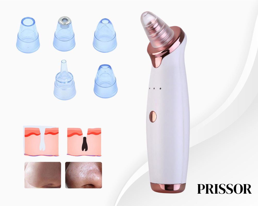 SUCCIONADOR DE POROS